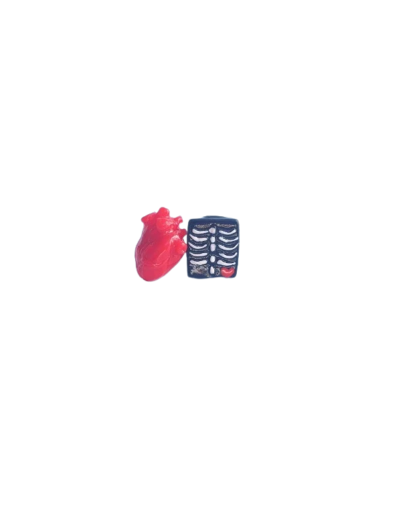 Artes corazon radiografia