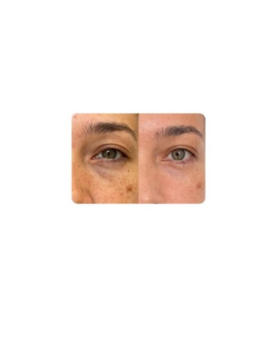 CONTORNO DE OJOS ARUNA-COMPLEJO ANTIEDAD 18 ml