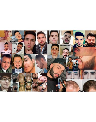 TÓNICOS DE CRECIMIENTO + SHAMPOO DE CEBOLLA BEARMEN