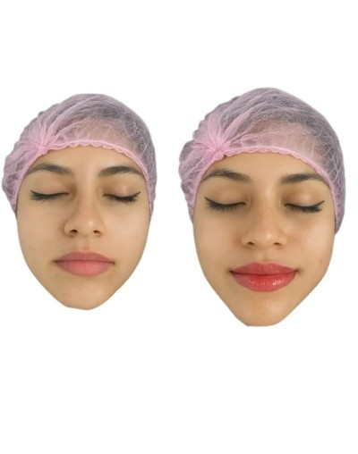 Hidratacion de labios
