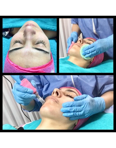 Detox Facial 